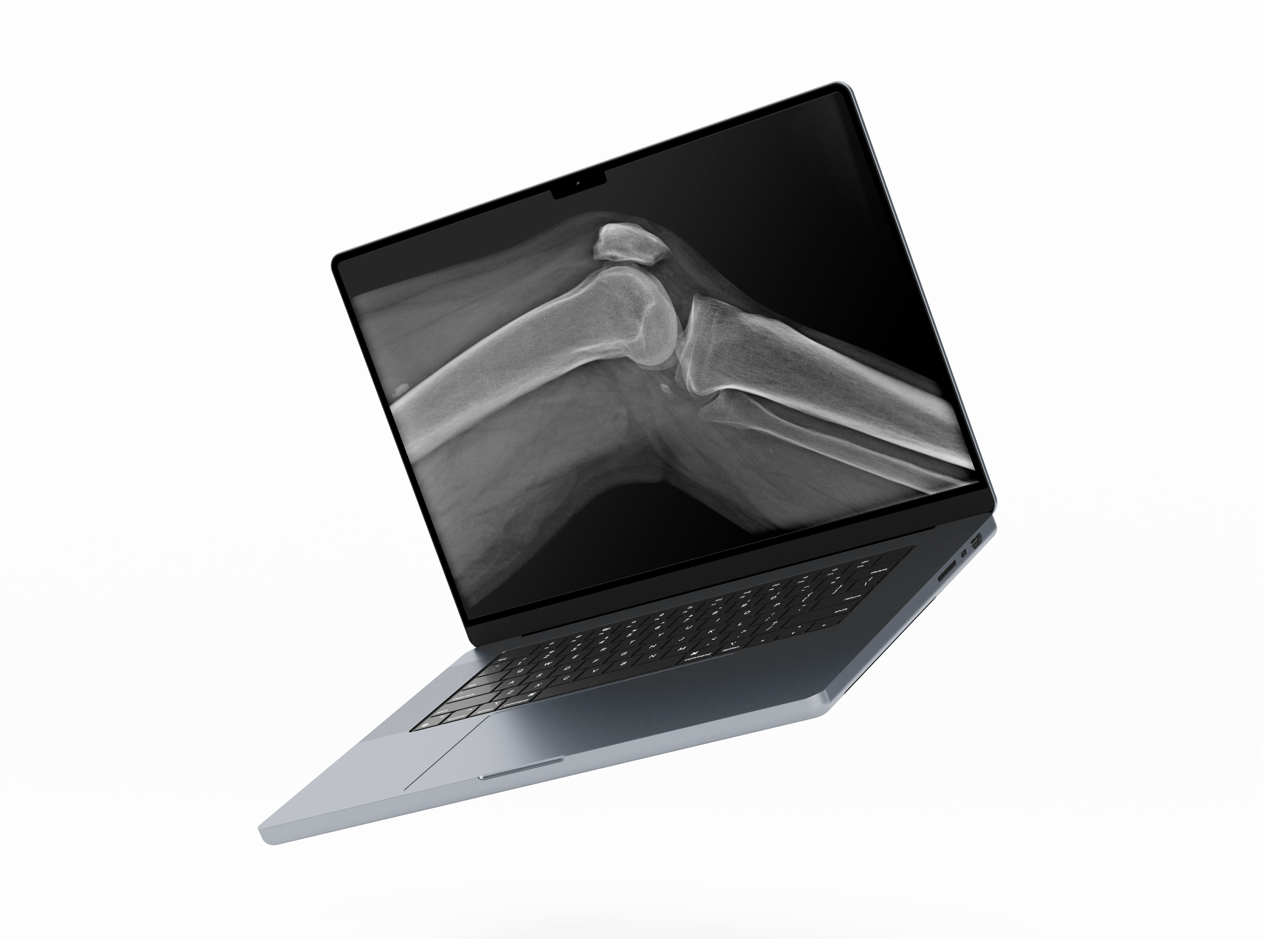 Pre-configured laptop